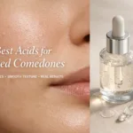 closed comedones on forehead texture